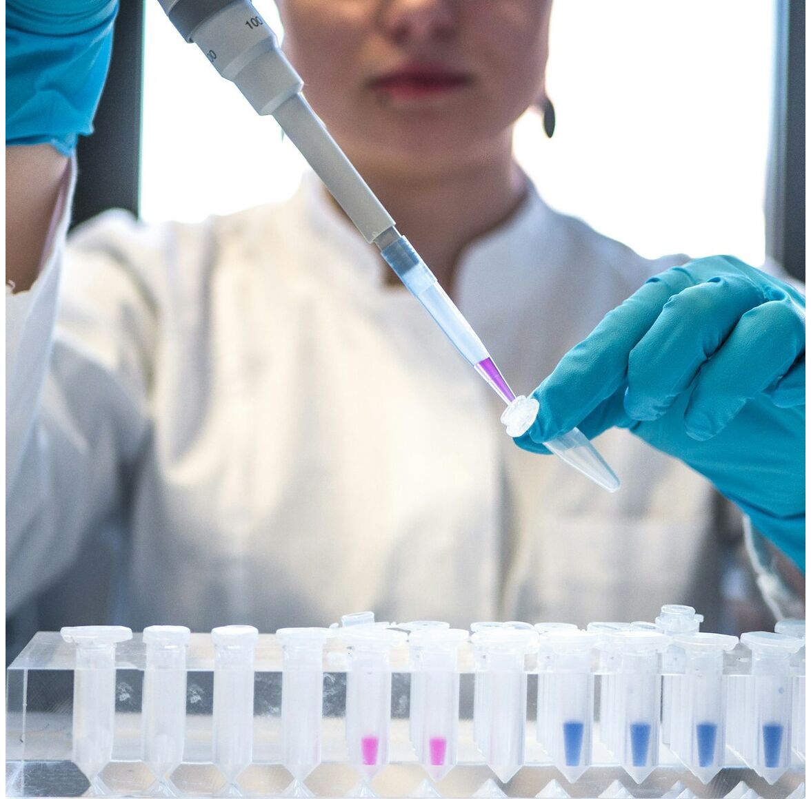 Fetal-DNA БАЗОВЫЙ ПЛЮС + 90 микроделеций