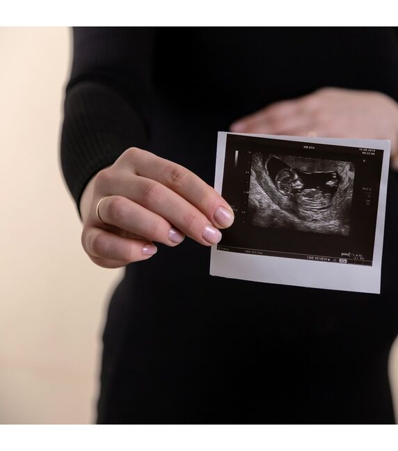 Fetal-DNA КАРИОТИП ПЛЮС